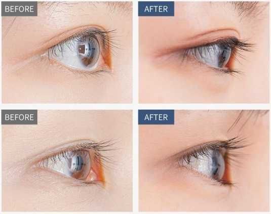 Benton: Benton Honest Eyelash Serum