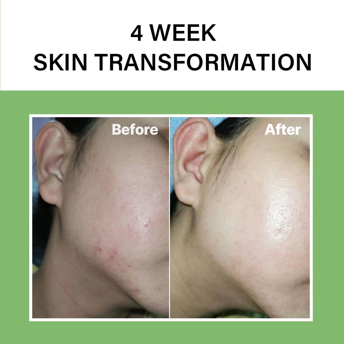 celimax: Noni Energy Ampoule