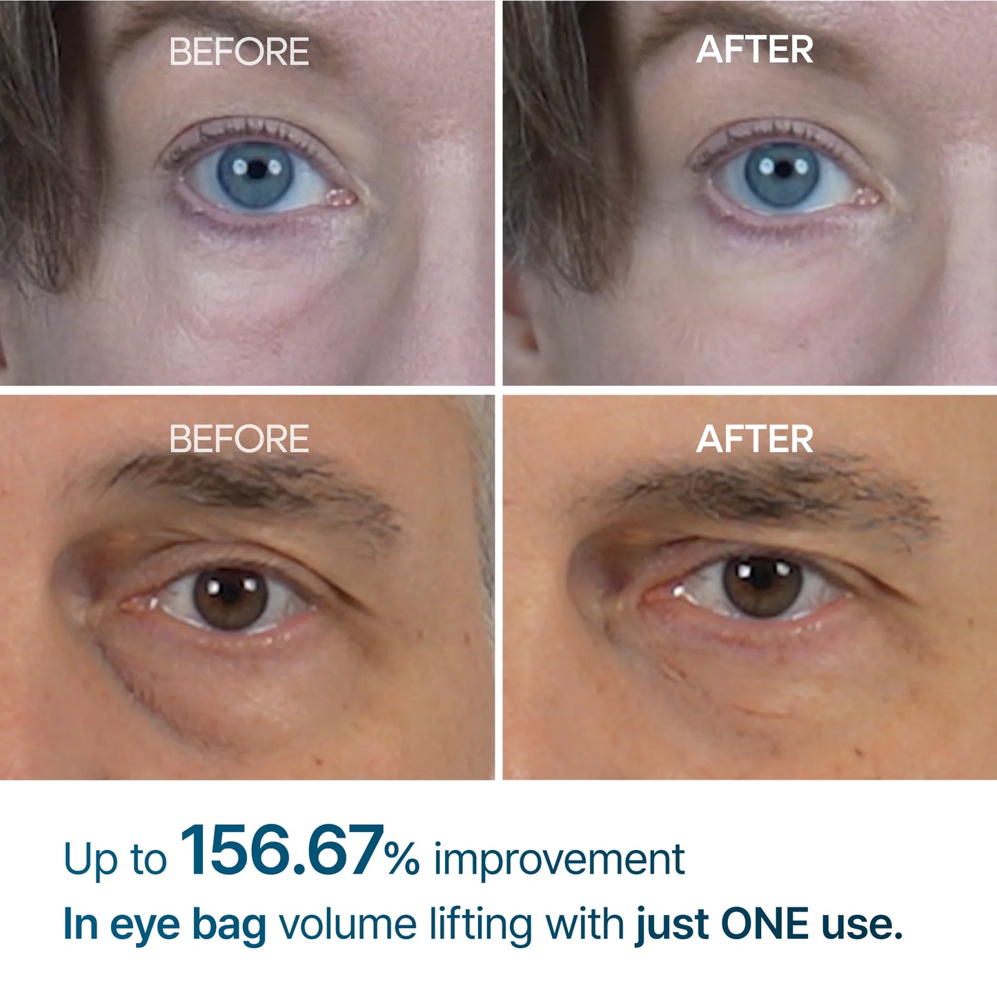 Dr.Melaxin: Eyephalt Eyecream for Eyebags