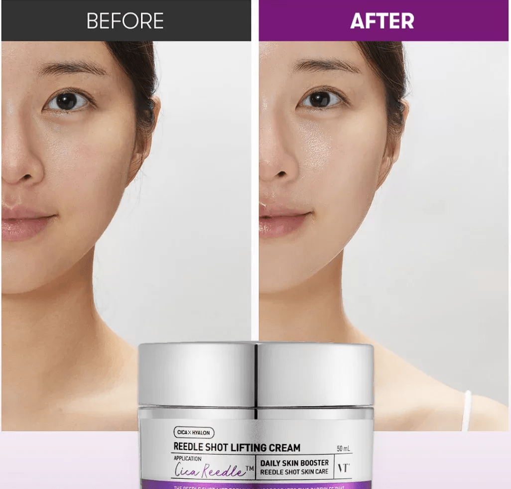 VT Cosmetics: Reedle Shot Lifting Cream