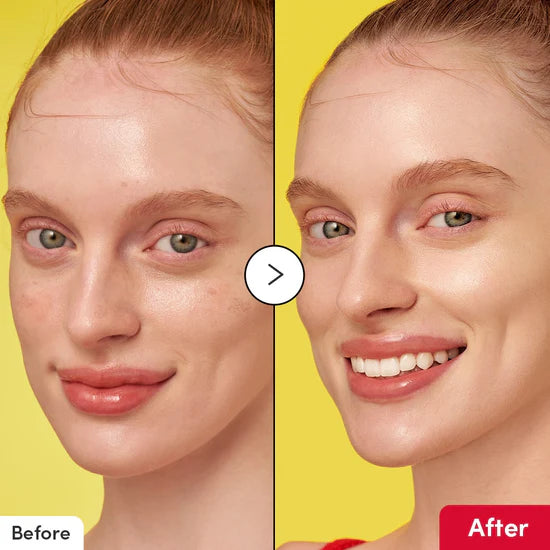 EQQUALBERRY: Vitamin Illuminating Serum