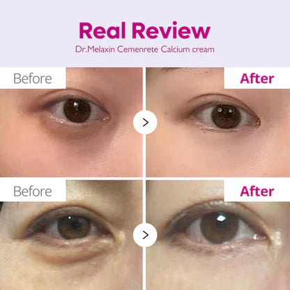 Dr.Melaxin: Calcium Dark Spot Cover Eye Cream