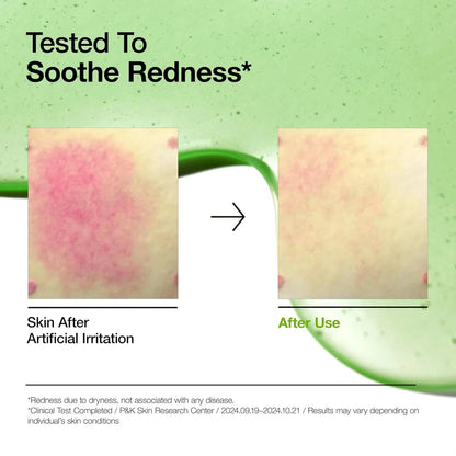 ANUA: Azelaic Acid 10 Hyaluron Redness Soothing Serum