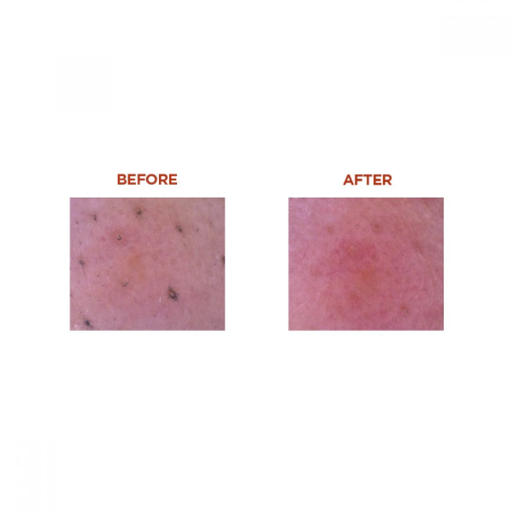 SKIN1004: Madagascar Centella Poremizing Deep Cleansing Foam Sumin K Beauty Panama