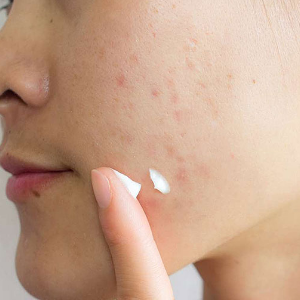 SKIN1004: Madagascar Centella Tea-Trica Spot Cream Sumin K Beauty Panama