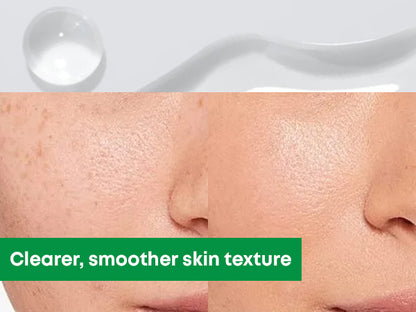 NINELESS: A-Control Azelaic Acid Toner