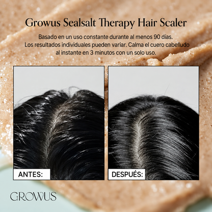 GROWUS: Sea Salt Therapy Scalp Scaler